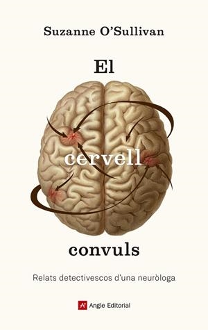 El cervell convuls | 9788417214586 | O?Sullivan, Suzanne | Llibres.cat | Llibreria online en català | La Impossible Llibreters Barcelona